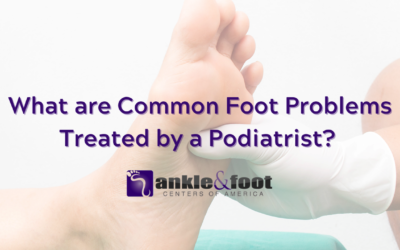 Common Foot Problems Treated by Podiatrists in Nashville, TN