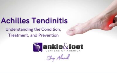 Achilles Tendinitis Treatment