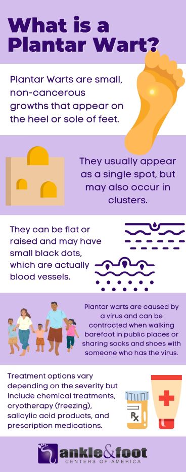 What Is A Plantar Wart