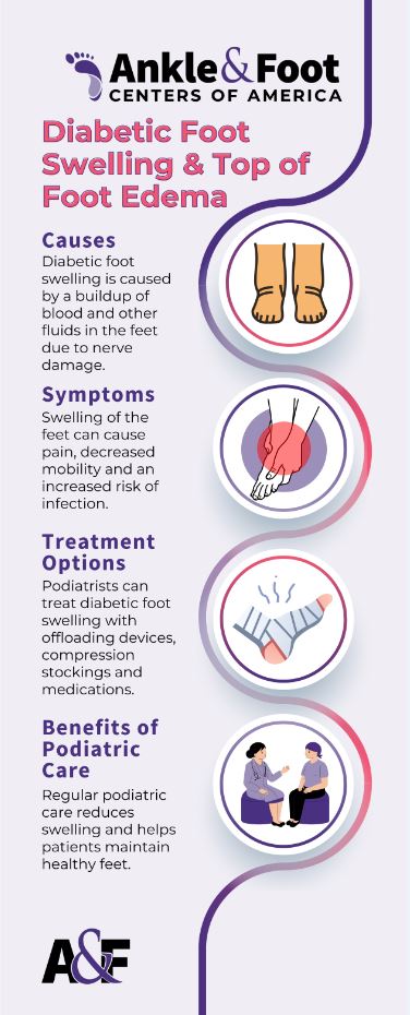 Diabetic Foot Swelling 