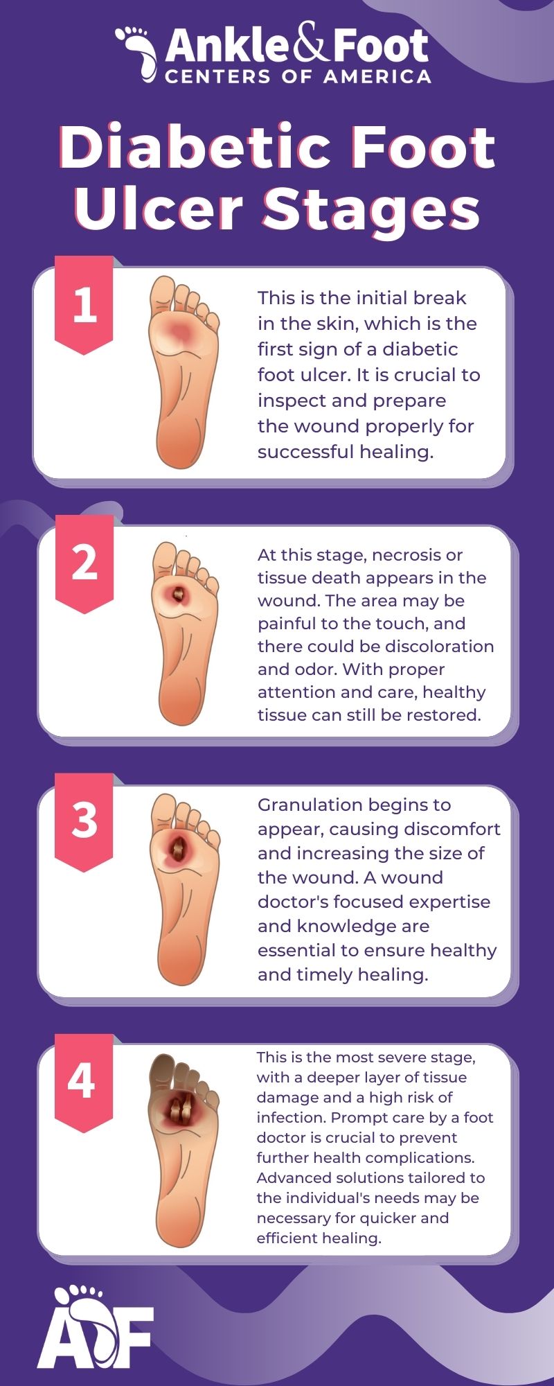 diabetic-foot-ulcer-treatment-prevention-what-to-know