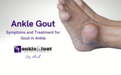 Ankle Gout: Symptoms, Treatment, and Effective Management