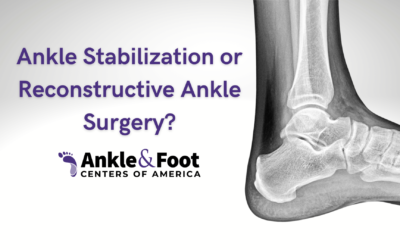 Ankle Stabilization Surgery