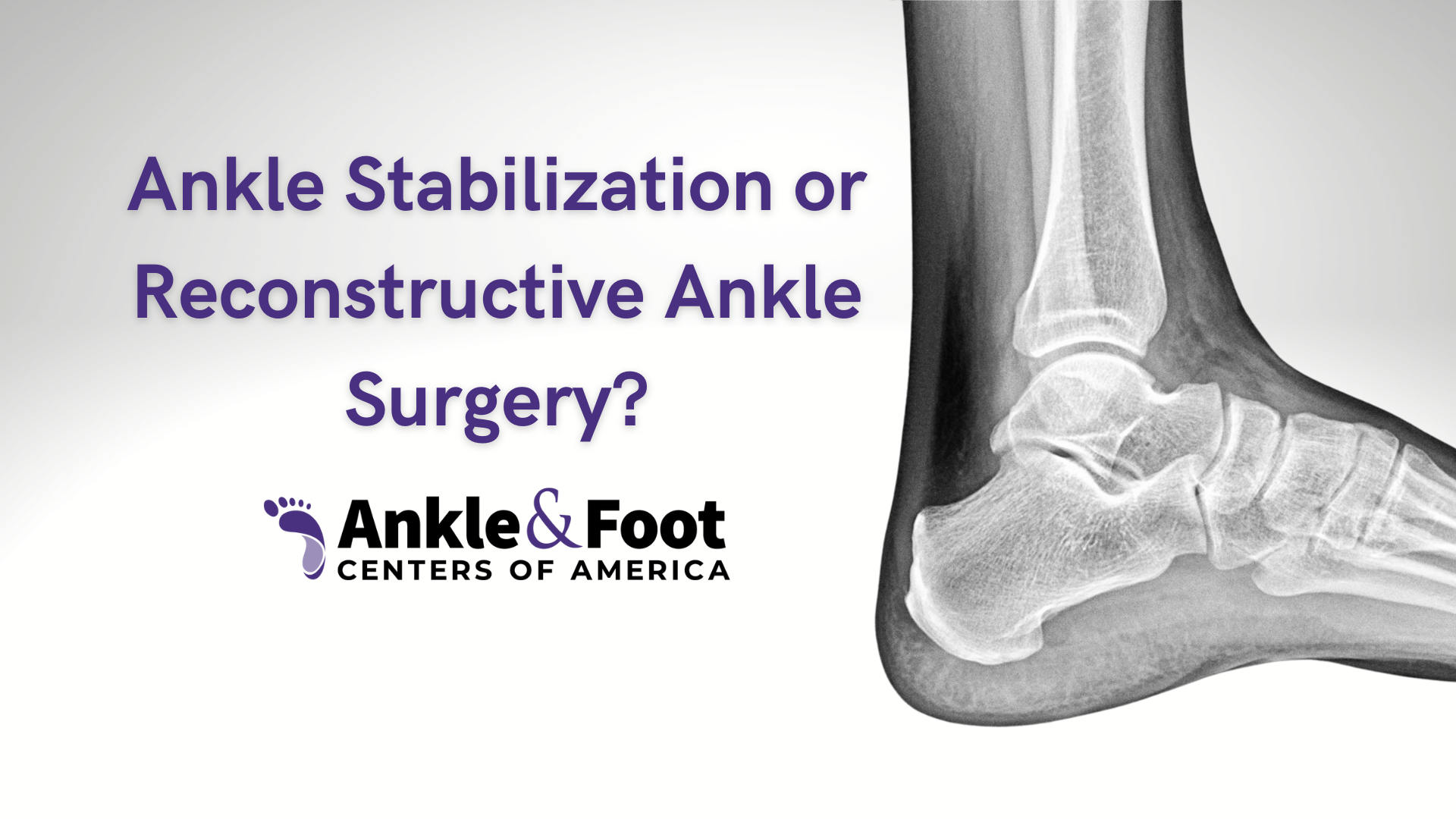 Reconstructive Ankle Surgery