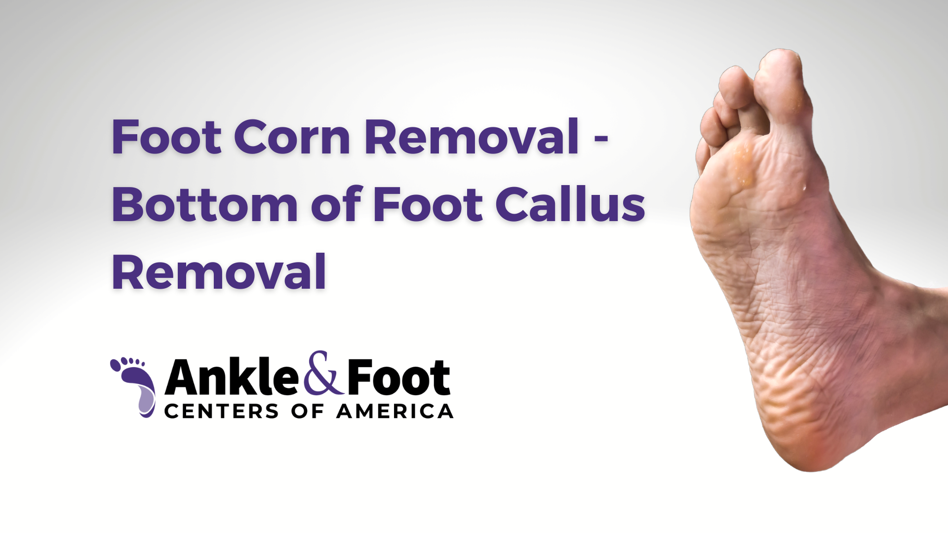 Foot Callus Removal
