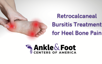 Understanding and Treating Retrocalcaneal Bursitis