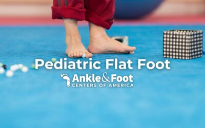 Pediatric Flat Foot: A Comprehensive Guide