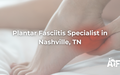 Plantar Fasciitis: Nashville Podiatrist Treatment Guide